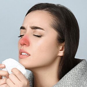PROTOCOLO CONGESTION NASAL